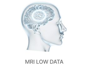 Brain structure analysis