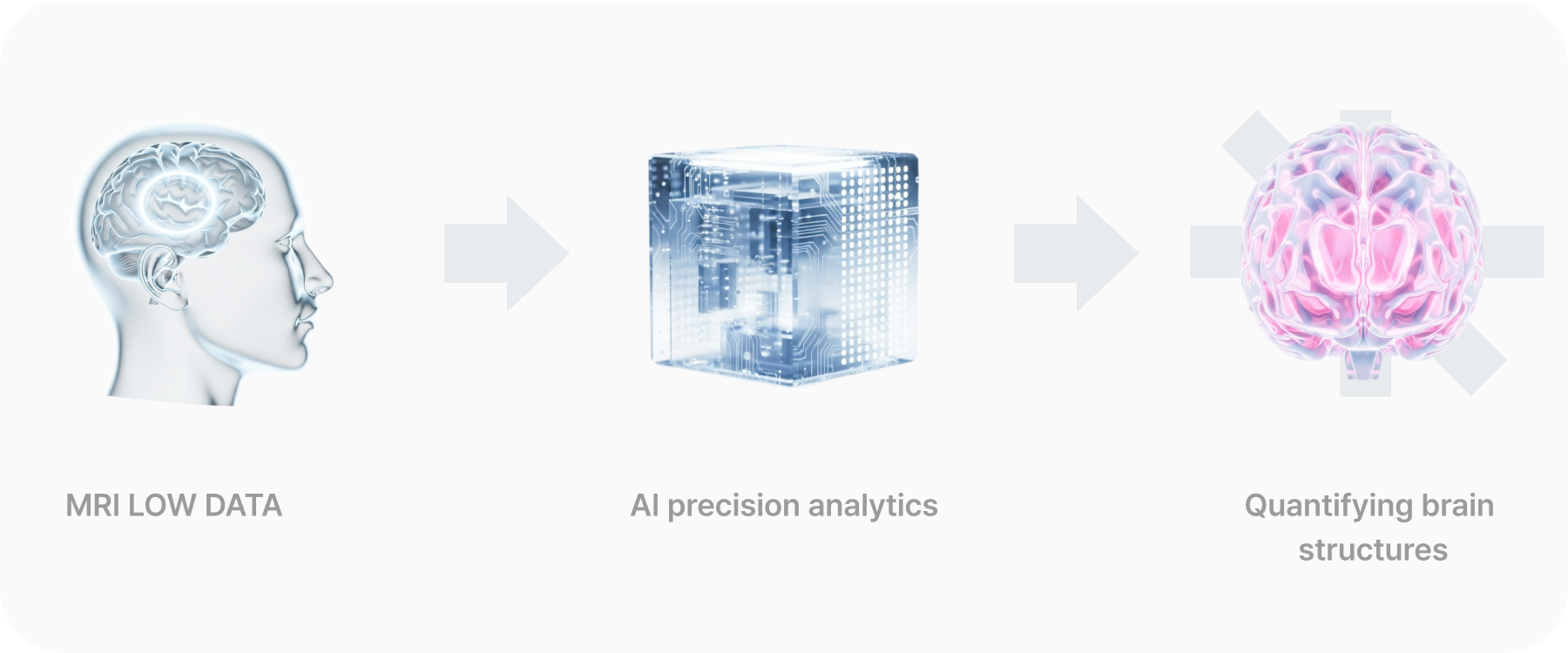 Brain structure analysis